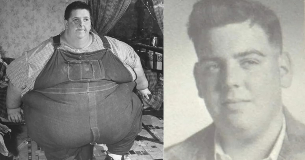 Jon Brower Minnoch: The Heaviest Person Ever Recorded, Weighing 1,400 Pounds